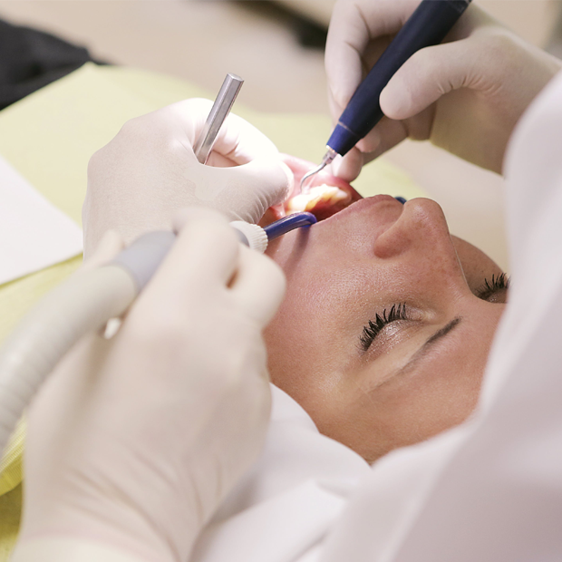 photo of dental cleaning in process