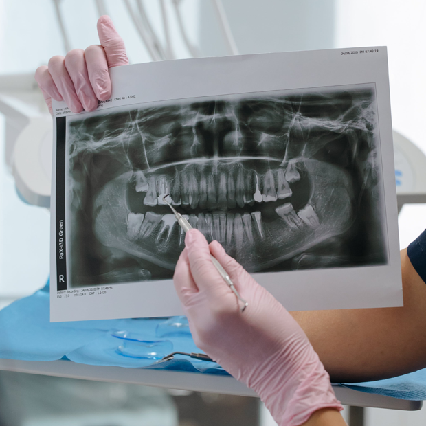 photo of dentist discussing x-rays with patient
